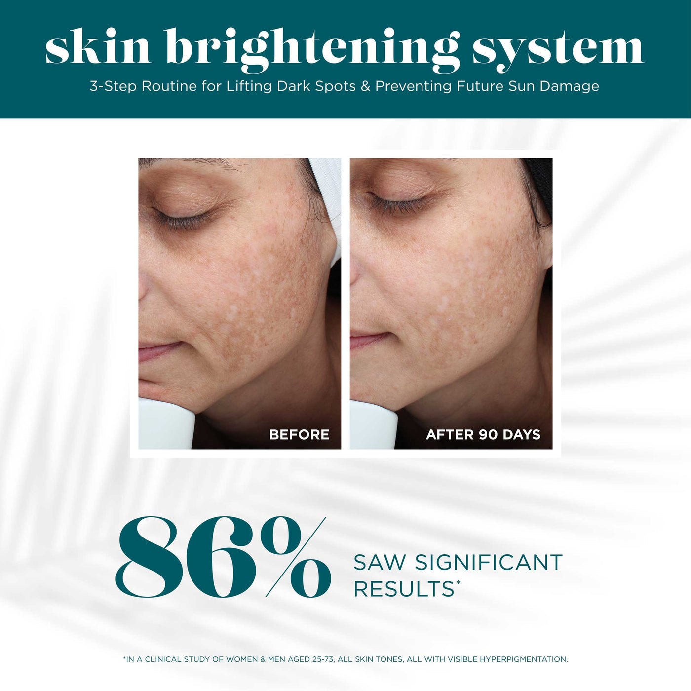 Skin Brightening System - Image 5